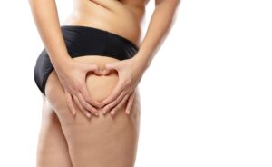 Descobrindo o Lipedema: 10 Curiosidades sobre Esta Condição Médica